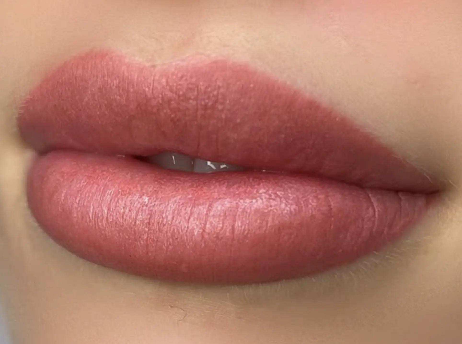 lip neutralization