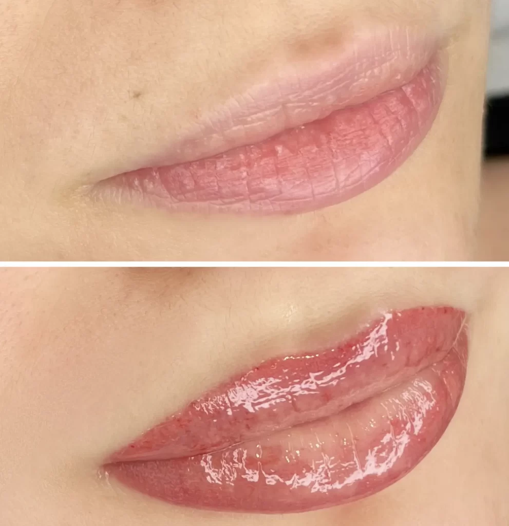 Is Getting a Lip Blush Worth It?