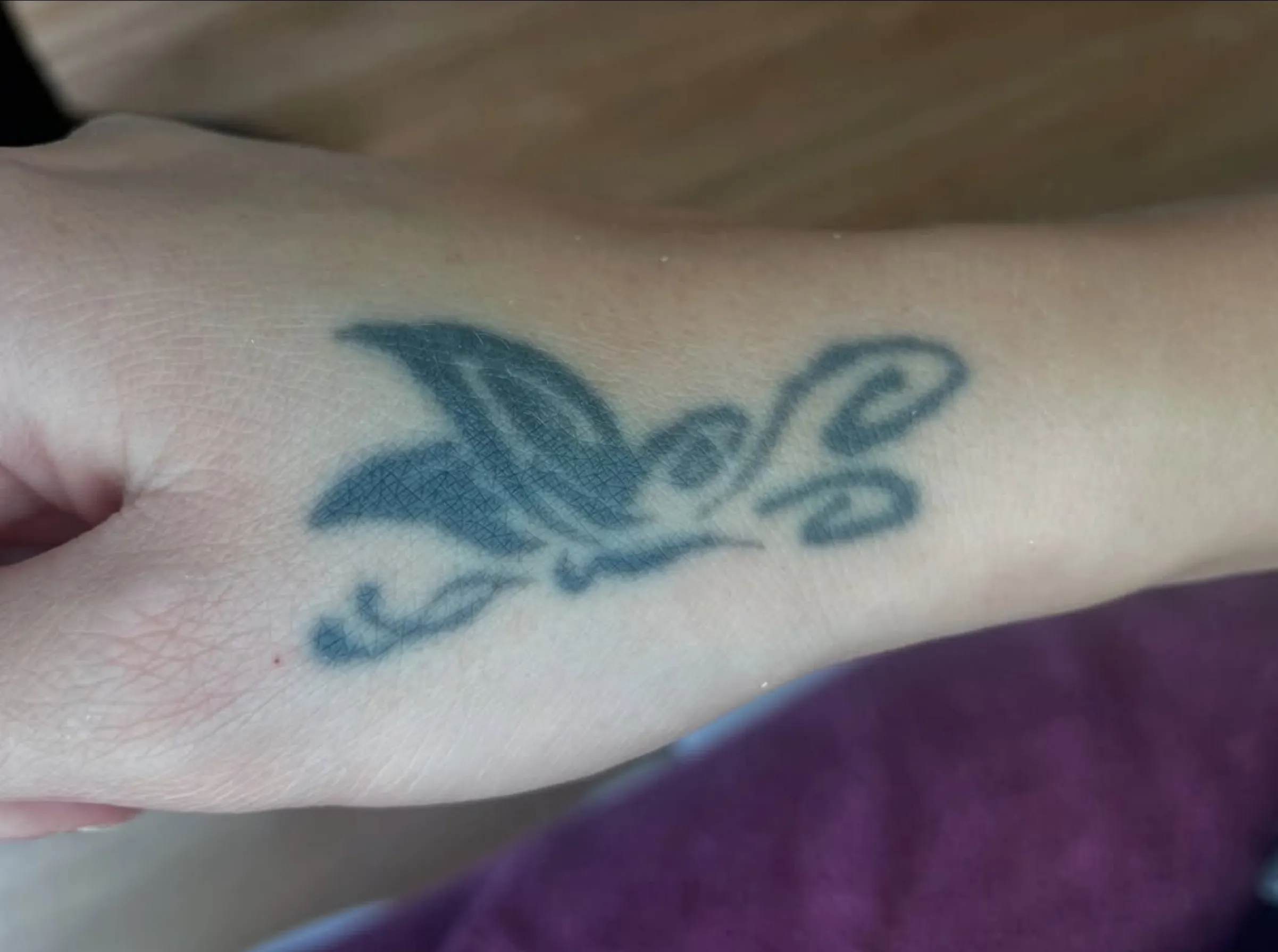 does aloe remove cosmetic tattoos